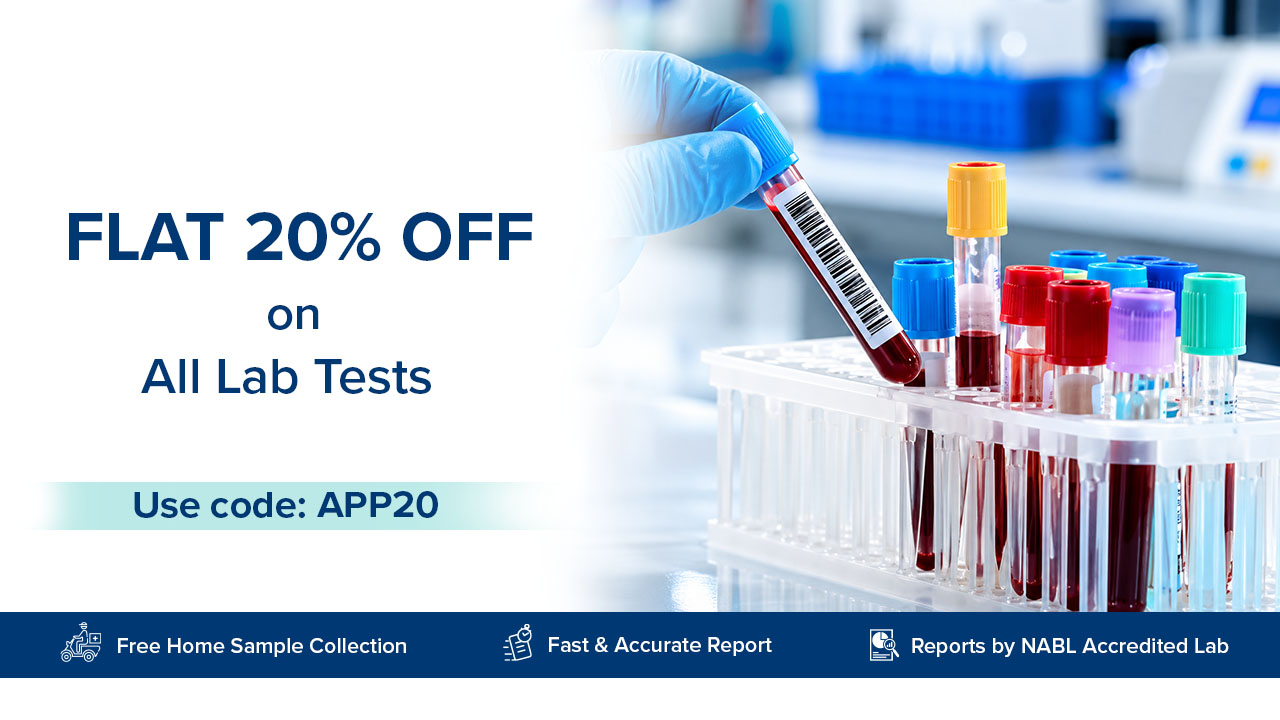 Flat 20% OFF on all lab tests. Use code APP20.